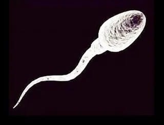 Given below is the diagram of a human sperm. Read the information below the diagram and fill in the blanks. ICSE 2026 Biology Solved Question Paper.