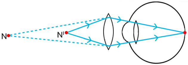 With the help of a diagram show how this defect of vision is corrected. CBSE 2026 Science Class 10 Sample Question Paper Solved.