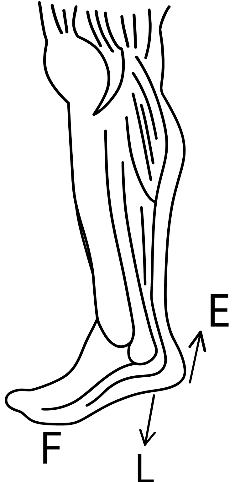 What type of lever is formed by the human body while. Machines, Concise Physics Solutions ICSE Class 10.