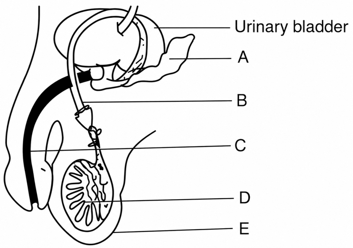 The diagram given below represents a surgical sterilisation method in males. Study the same and answer the questions that follow:. Population & Related Problems in India, ICSE Class 10 Biology by Goyal Brothers Solutions.