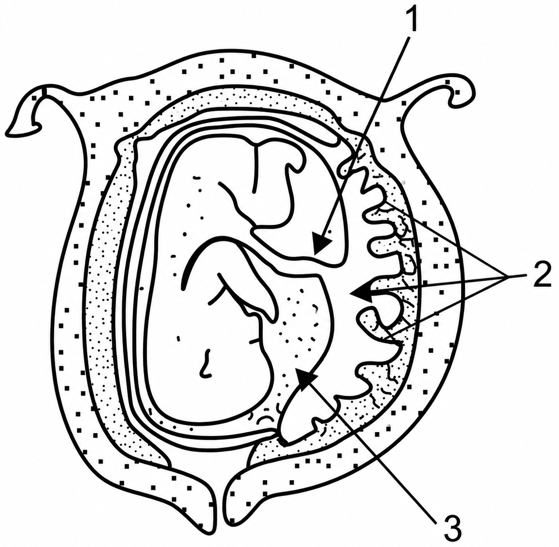 The diagram given below is of a developing human foetus in the womb. Study the same and then answer the questions that follow:. The Reproductive System, ICSE Class 10 Biology by Goyal Brothers Solutions.